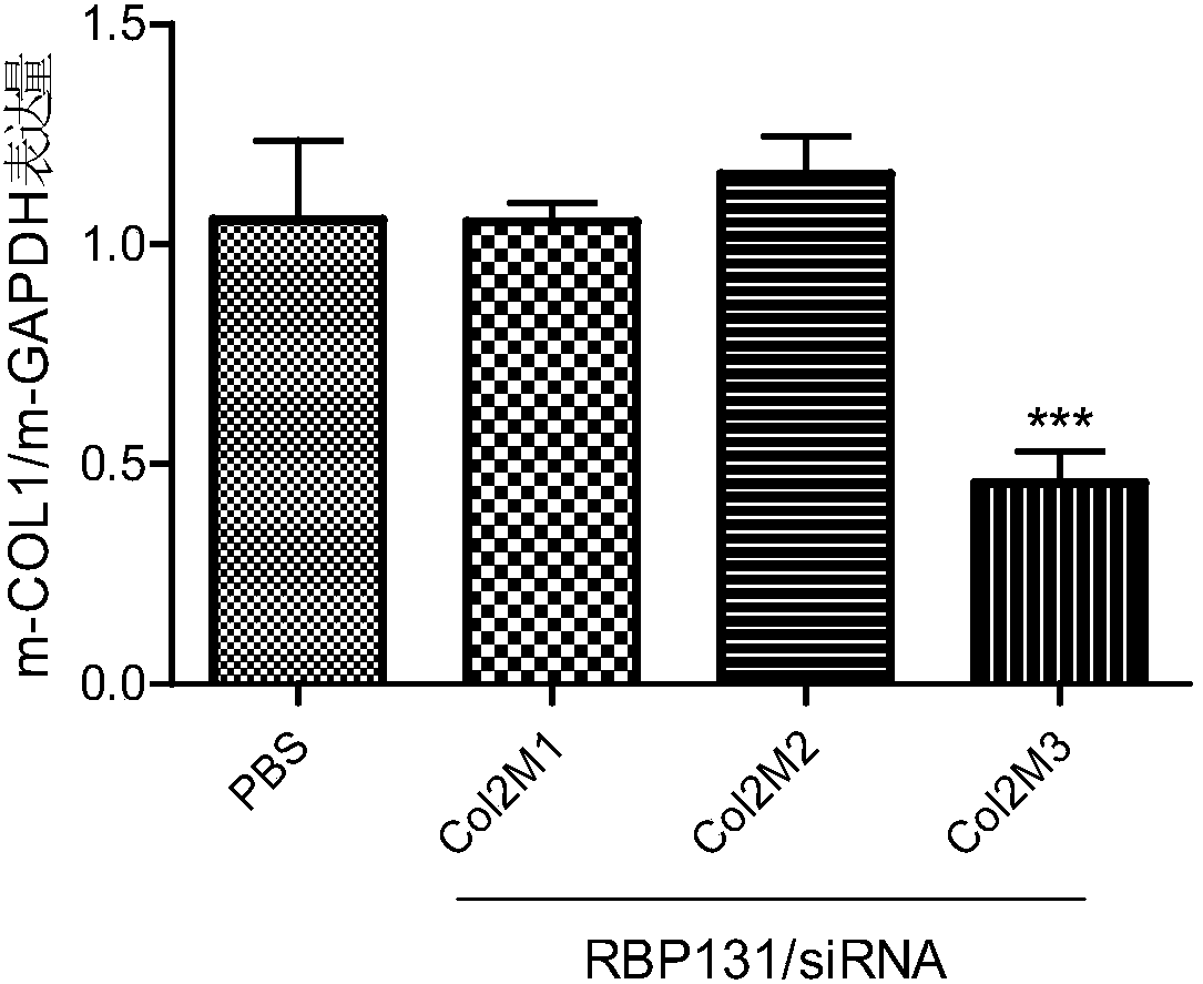 siRNA capable of inhibiting expression of COL1A1 gene in human beings and animals and composition containing same, and application thereof