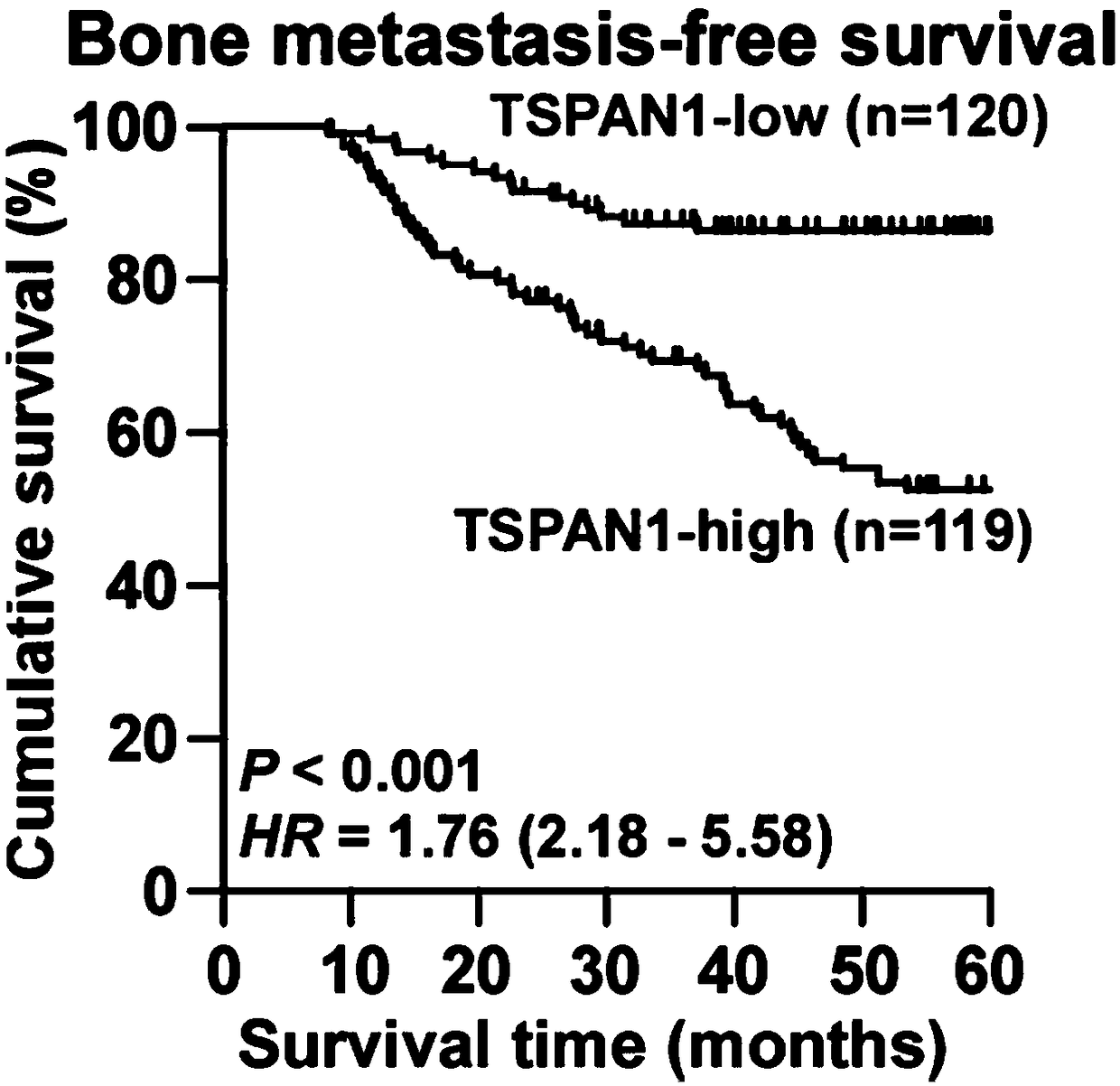 Application of TSPAN1 in diagnosis, prognosis and treatment of breast cancer metastasis