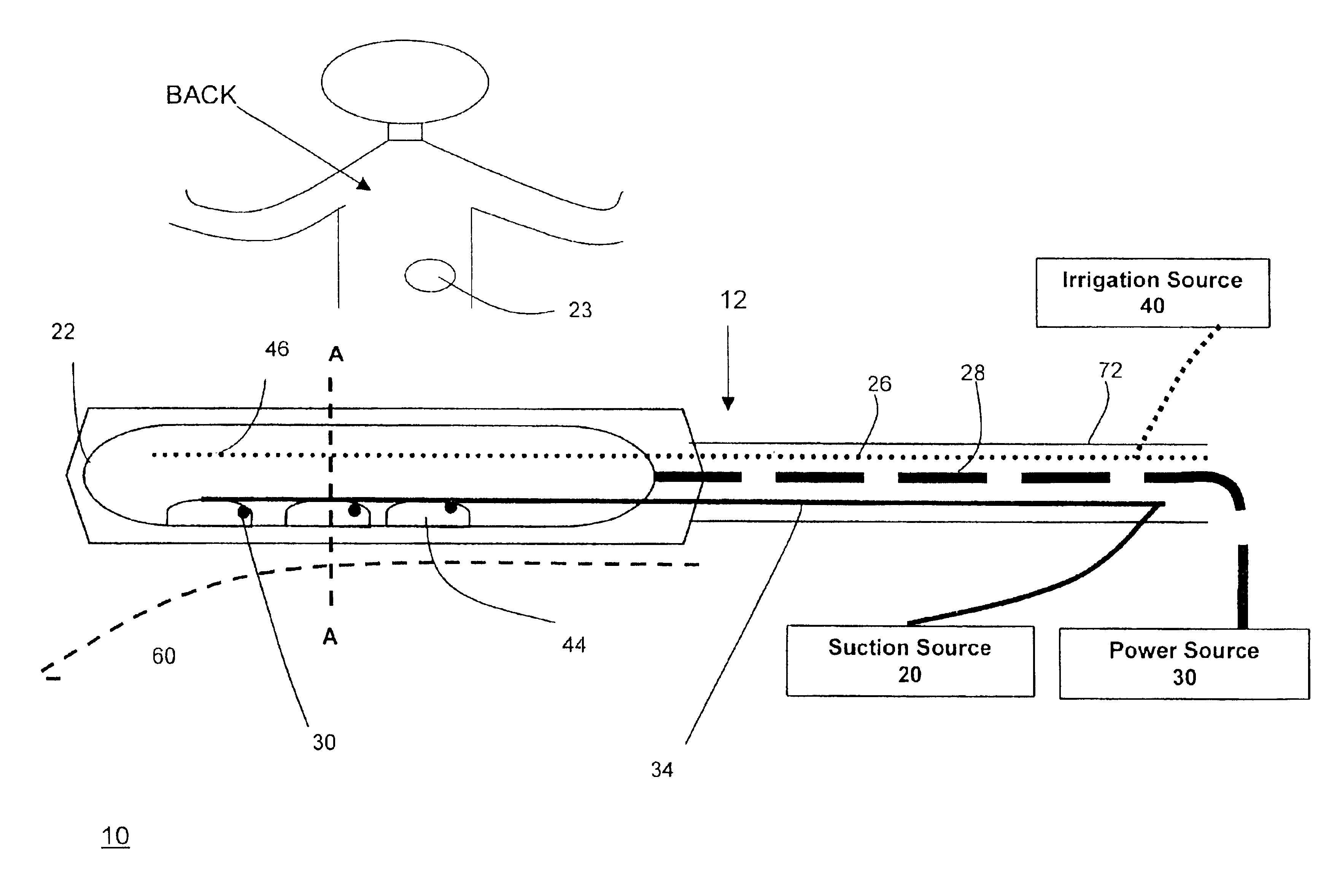 Suction stabilized epicardial ablation devices