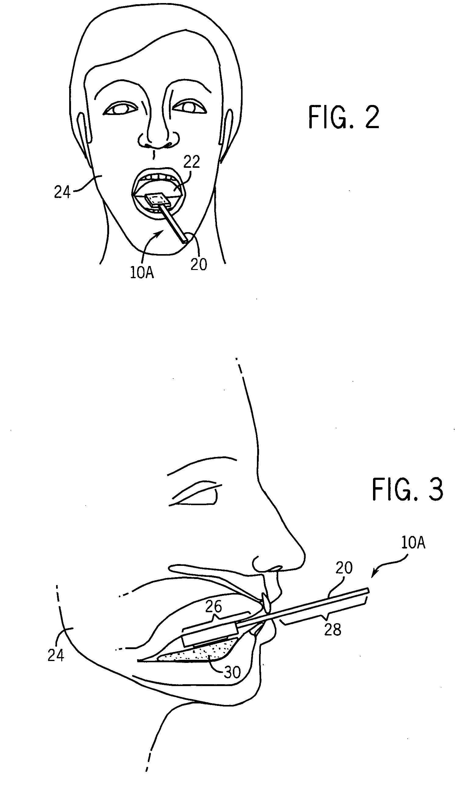 Sensor for tissue gas detection and technique for using the same