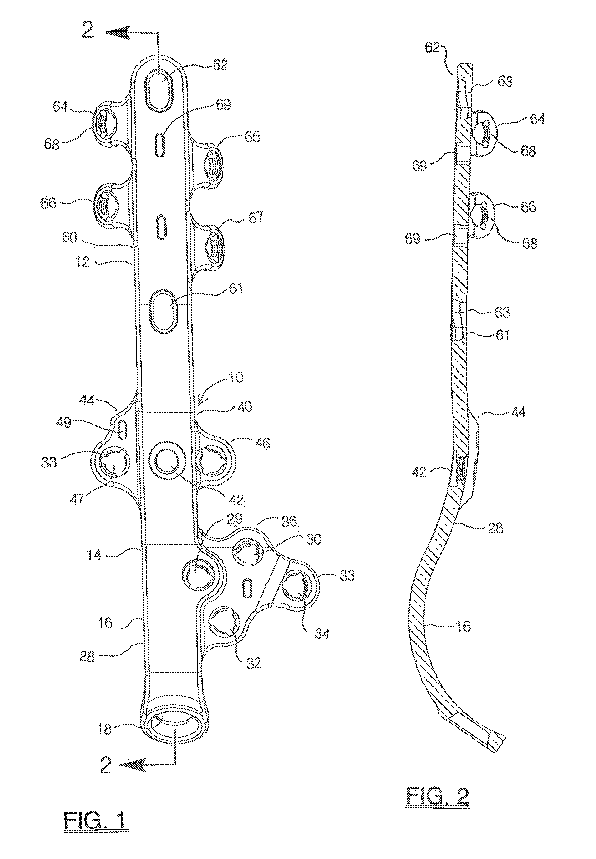 Lateral ankle fusion plate system and jig, and method for use therewith