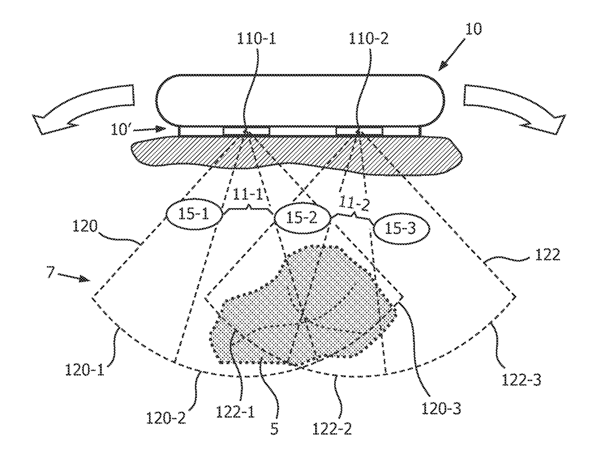 System and method for acoustic imaging with coherent compounding using intercostal spaces