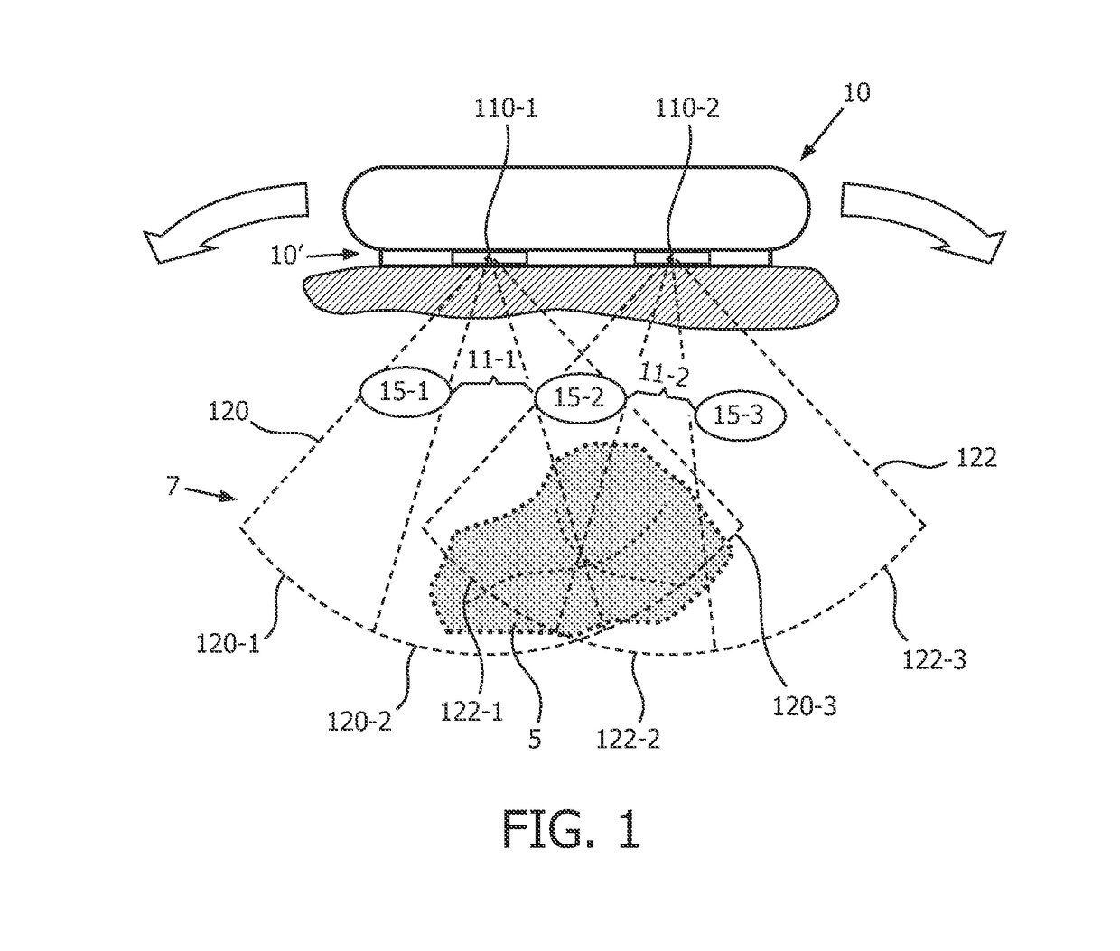 System and method for acoustic imaging with coherent compounding using intercostal spaces