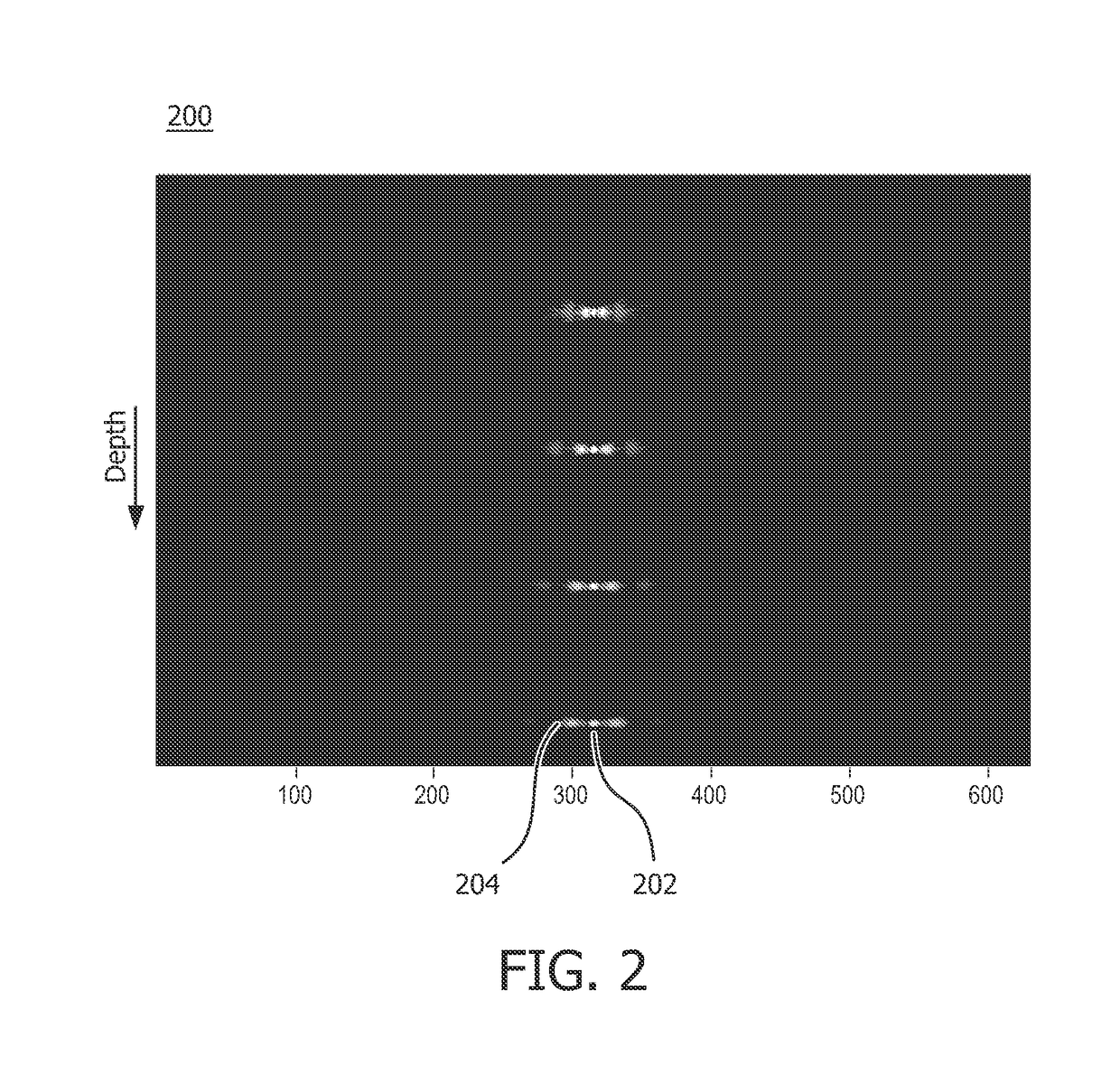 System and method for acoustic imaging with coherent compounding using intercostal spaces