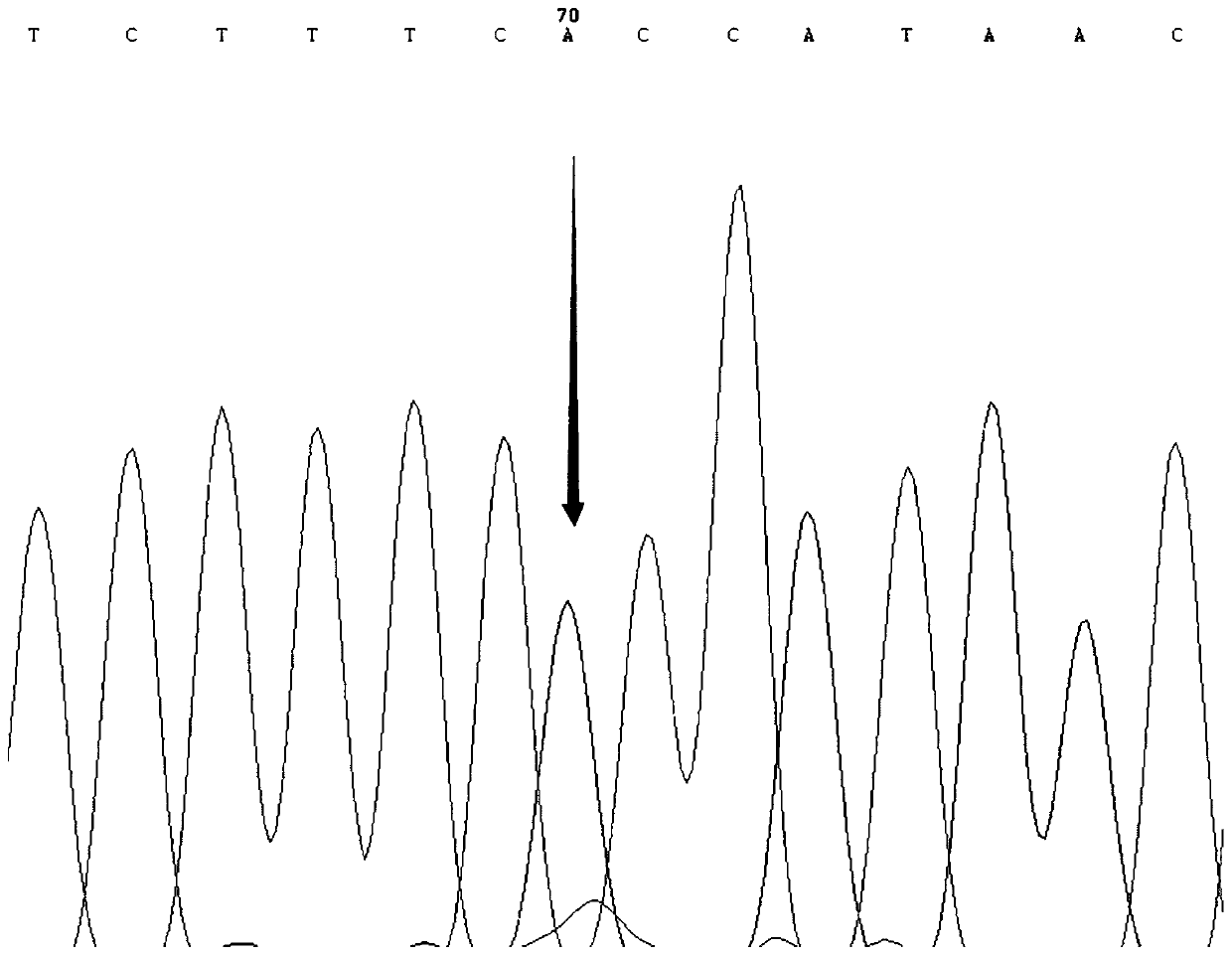 SNP molecular marker for distinguishing Takifugu fasciatus Zhongyang No. 1 from common Takifugu fasciatus and application of SNP molecular marker