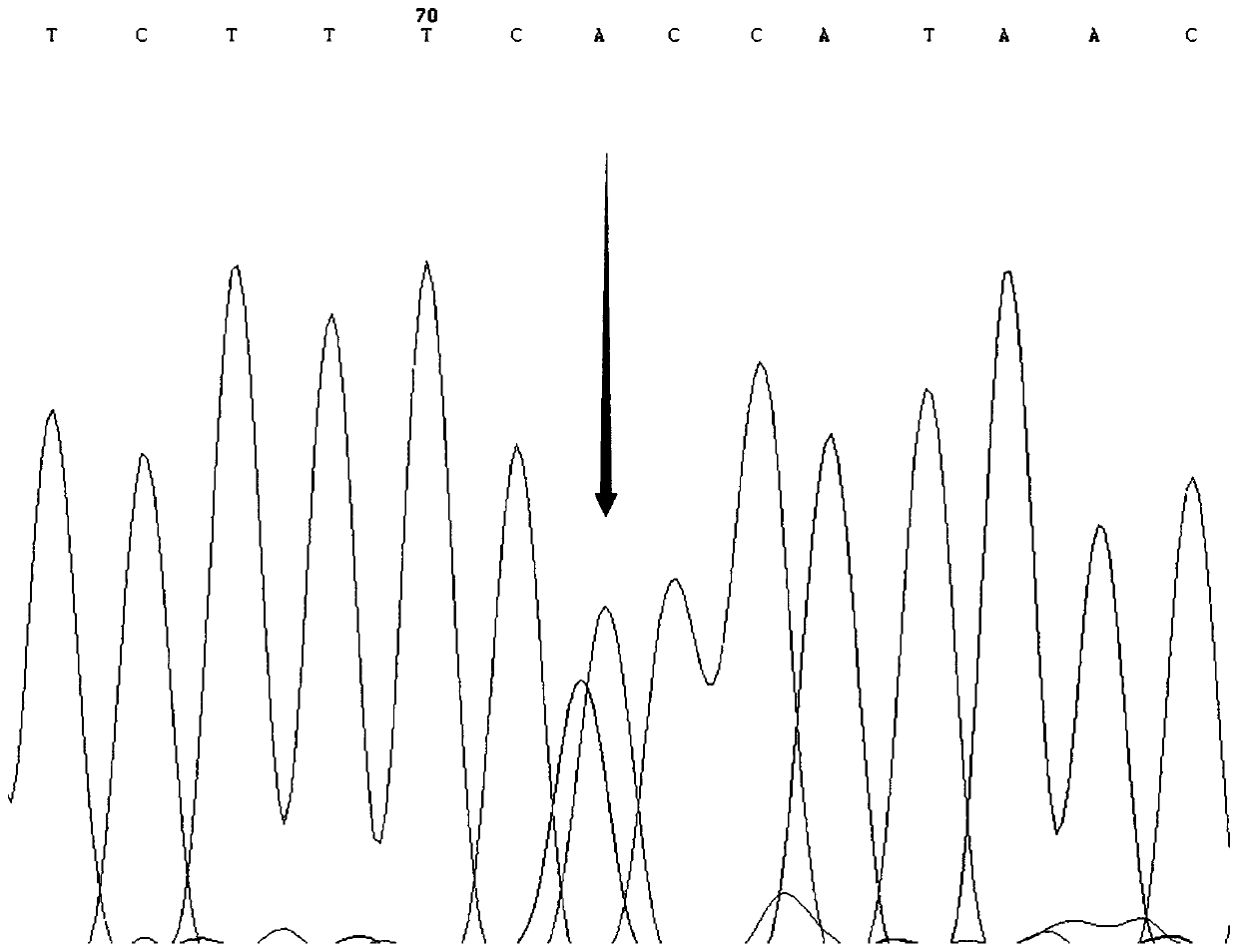 SNP molecular marker for distinguishing Takifugu fasciatus Zhongyang No. 1 from common Takifugu fasciatus and application of SNP molecular marker