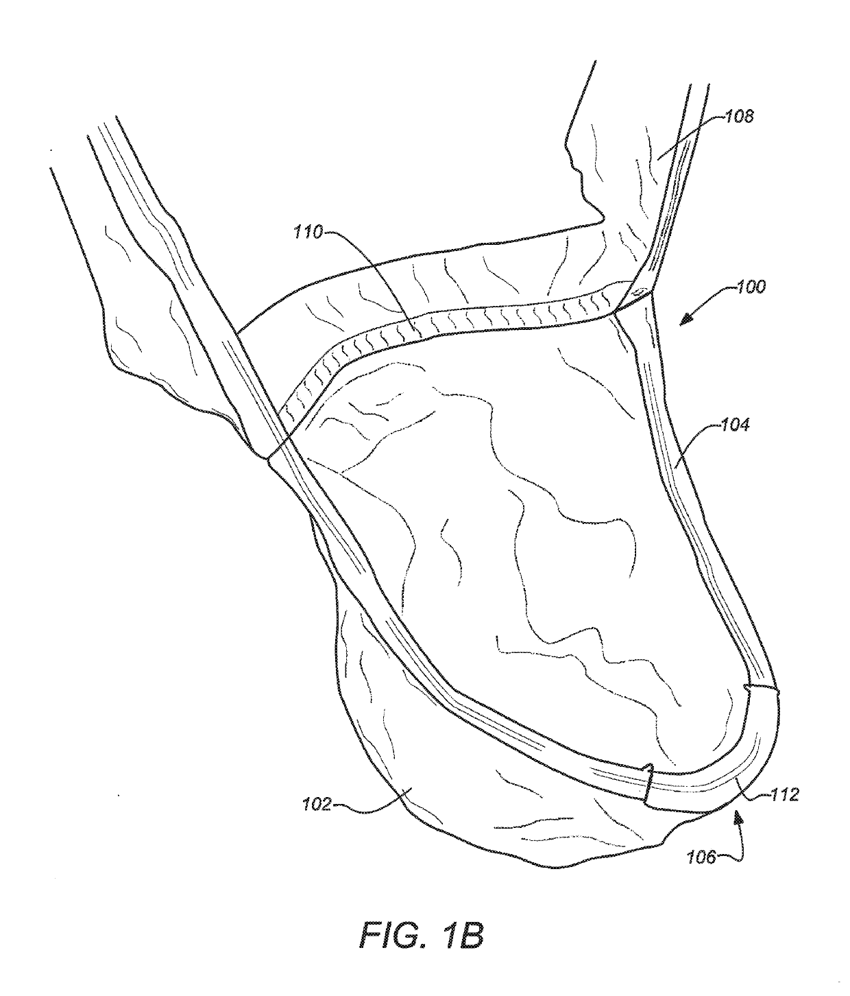 Male undergarment to protect against excess heat, moisture, and friction