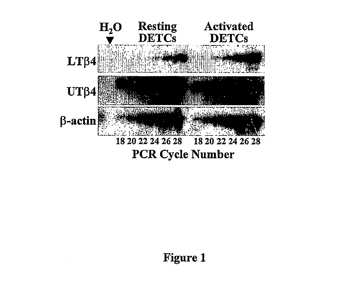 Anti-inflammatory and wound healing effects of lymphoid thymosin b-4