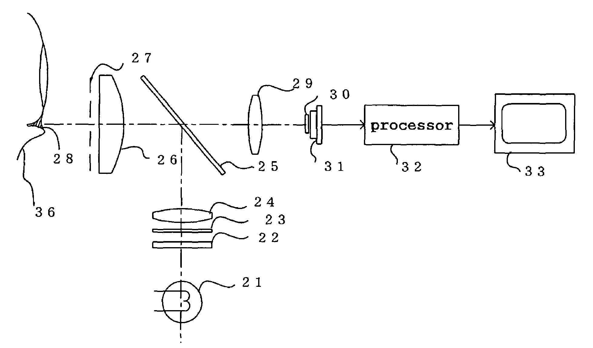 Ophthalmic apparatus