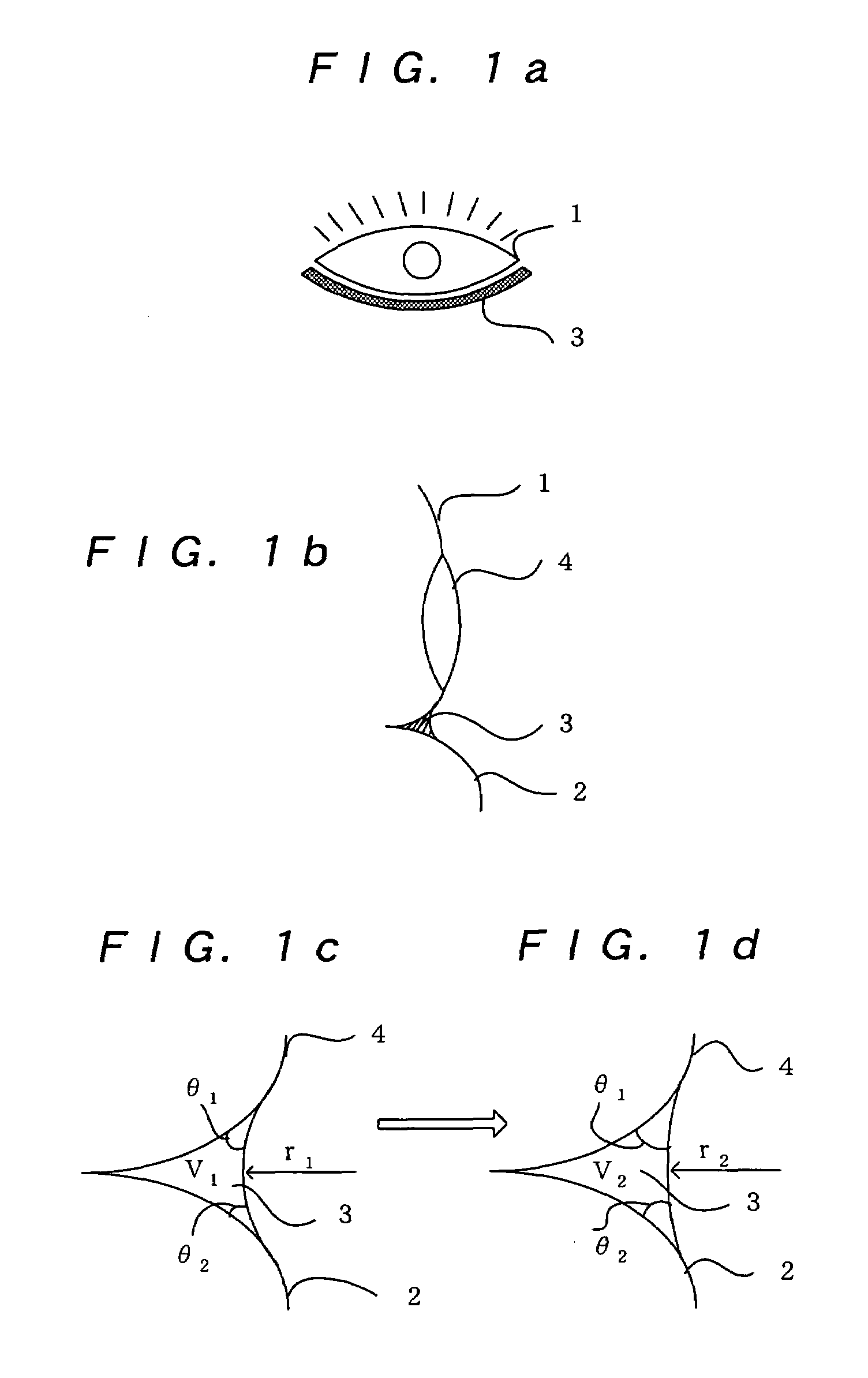 Ophthalmic apparatus