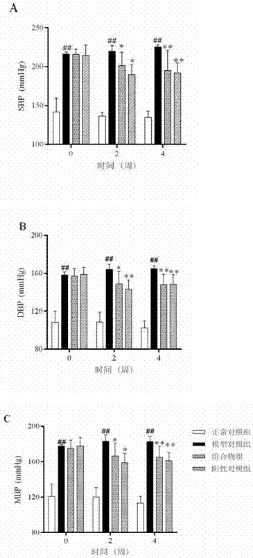 Traditional Chinese medicine composition and application thereof in preparation of drugs for preventing or treating hypertension