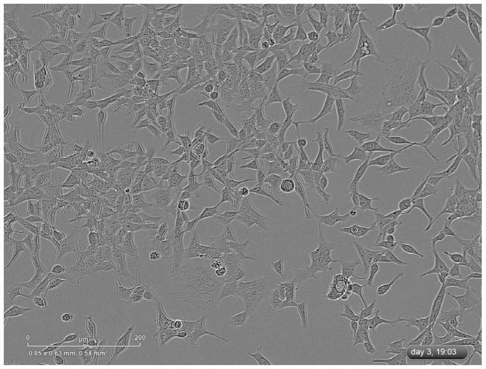 A heptapeptide anti-aβ protein aggregation and its application and gene encoding the synthetic polypeptide