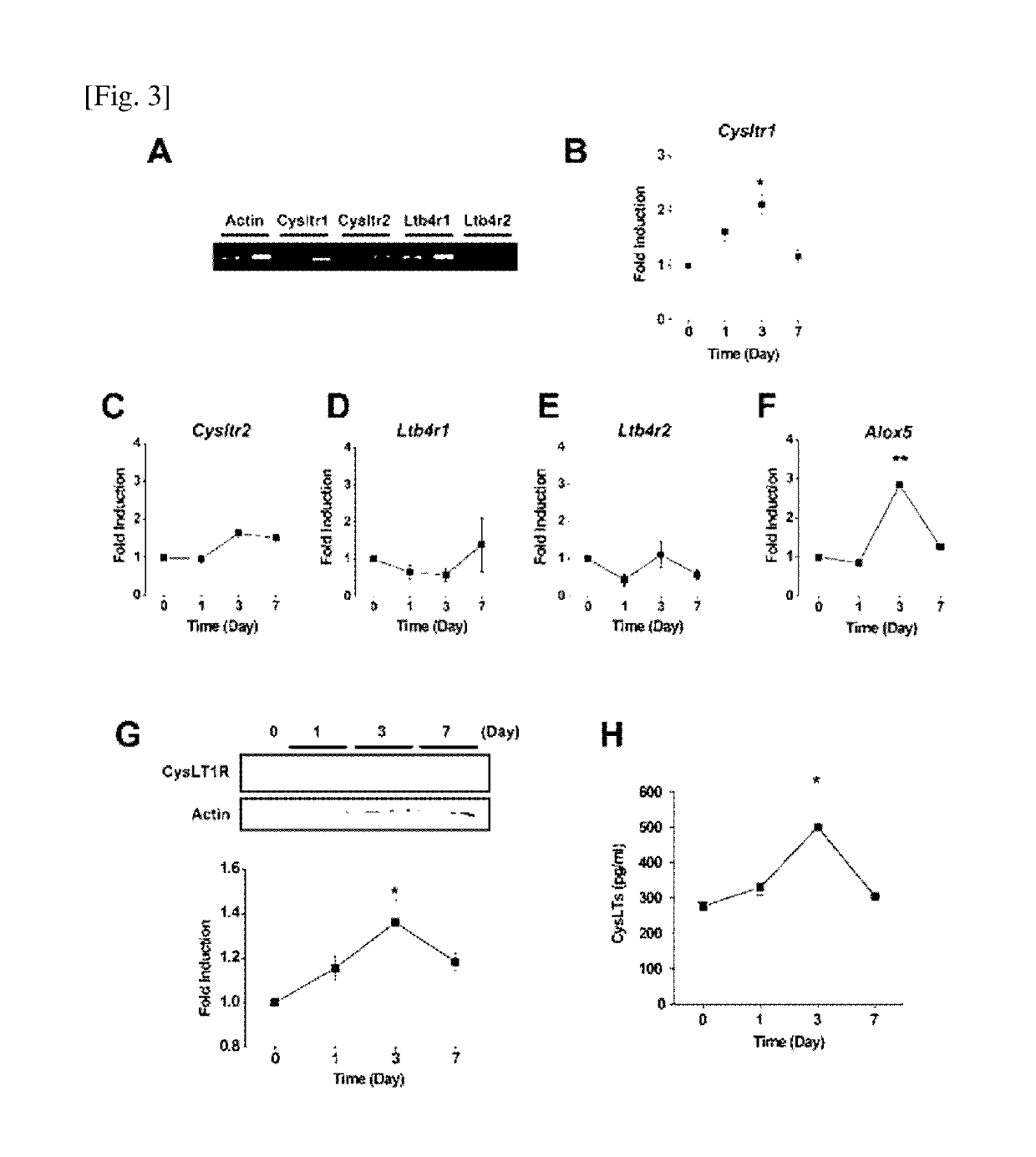 Pharmaceutical composition for treating or preventing sensorineural hearing loss, containing cysteinyl leukotriene receptor antagonist and ginkgo leaf extract