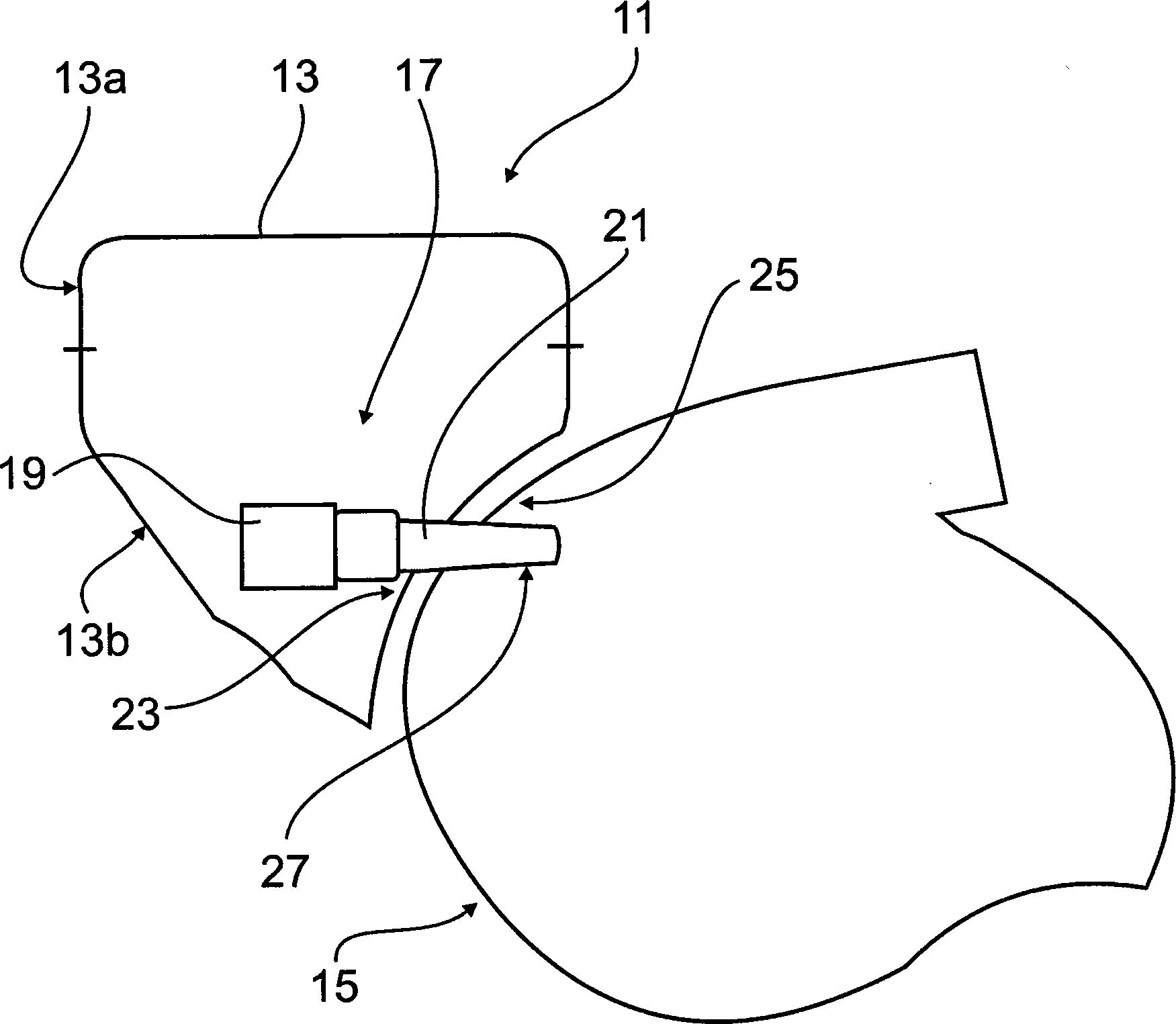 Fuel supply system