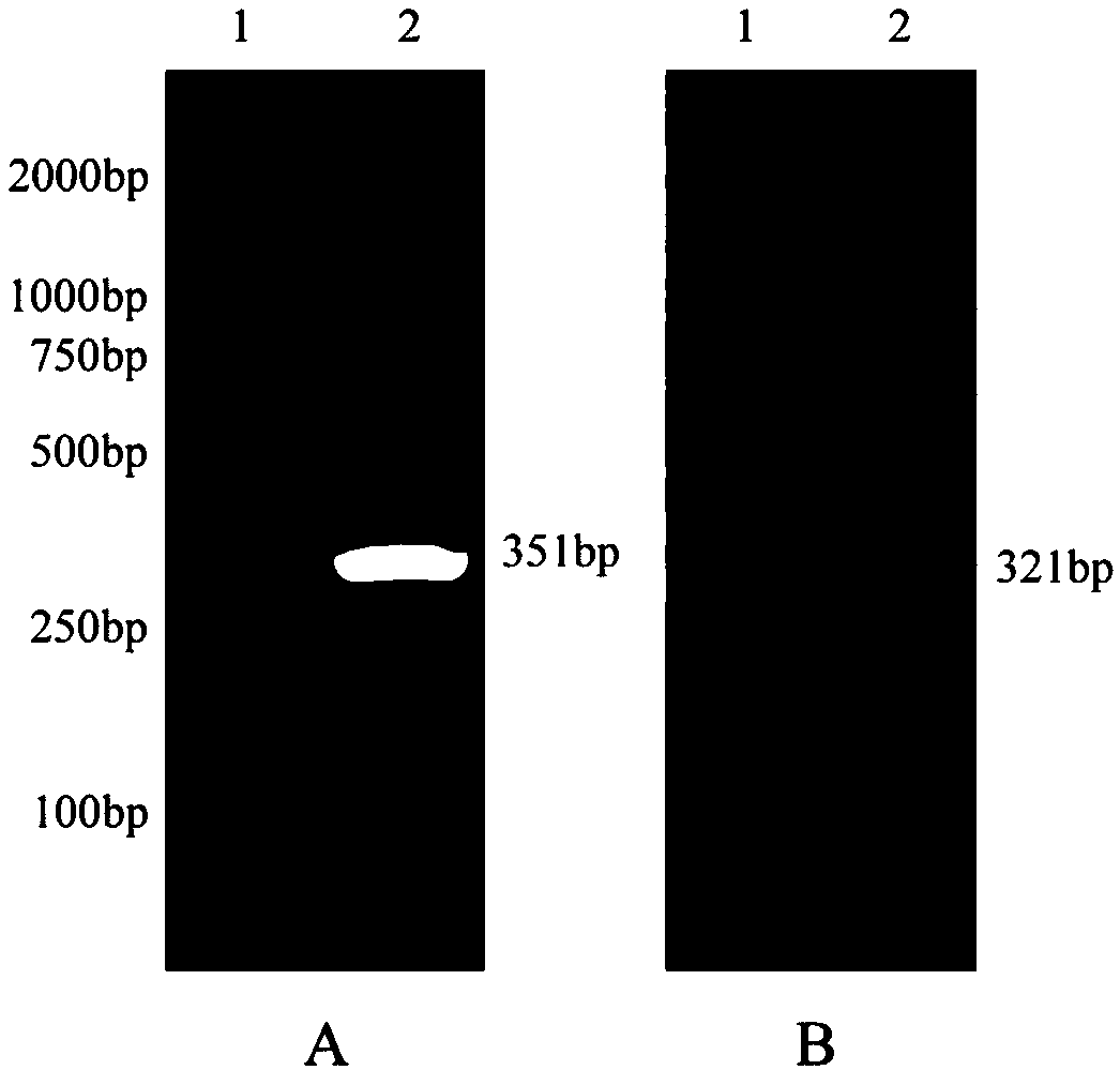 Chimeric antigen receptor targeting CD5 and application thereof