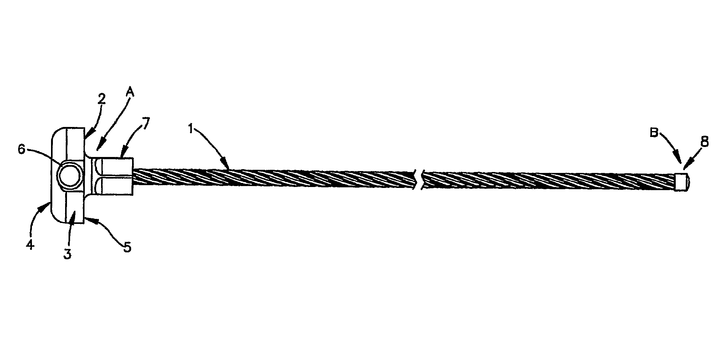 Sternal reconstruction system