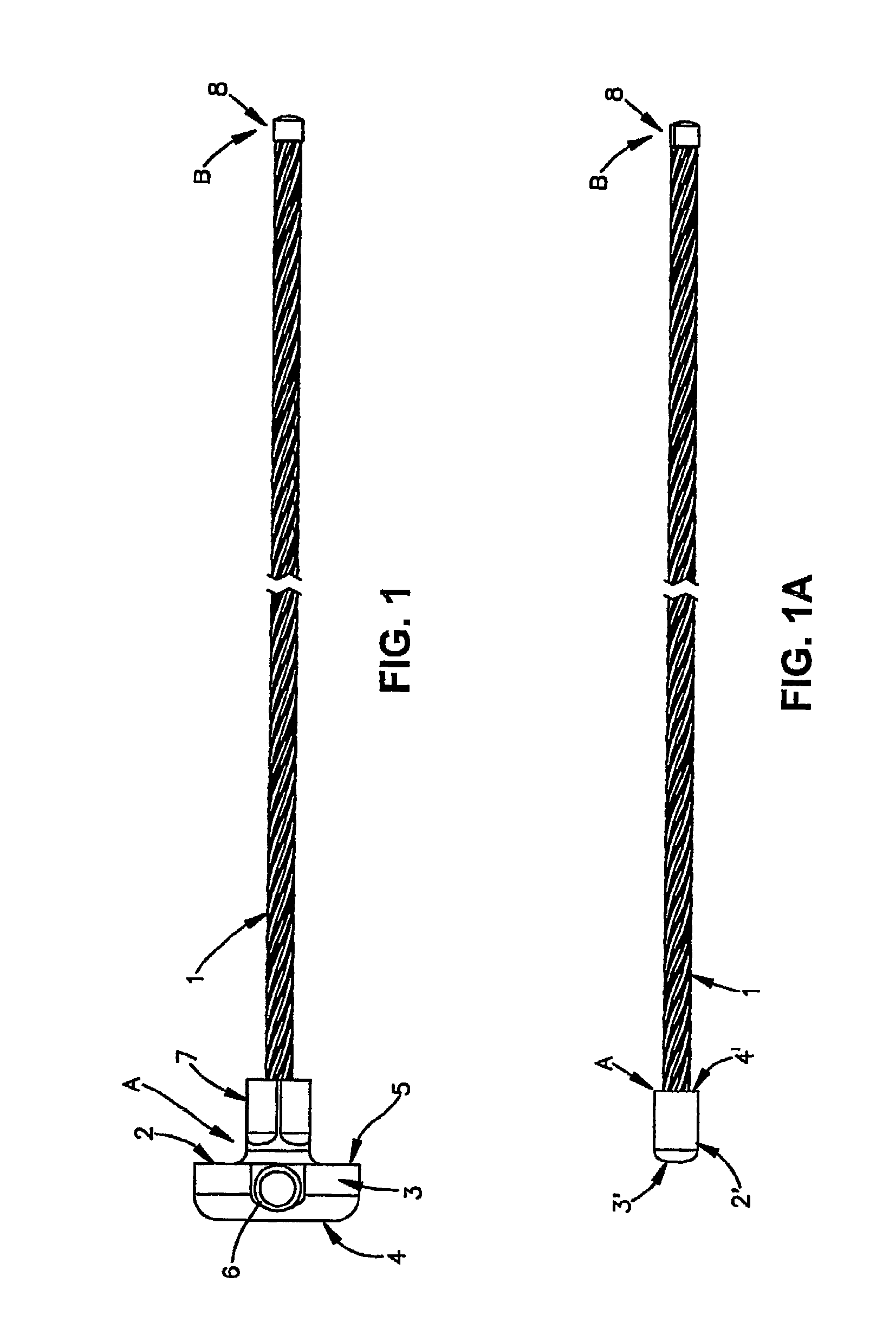 Sternal reconstruction system