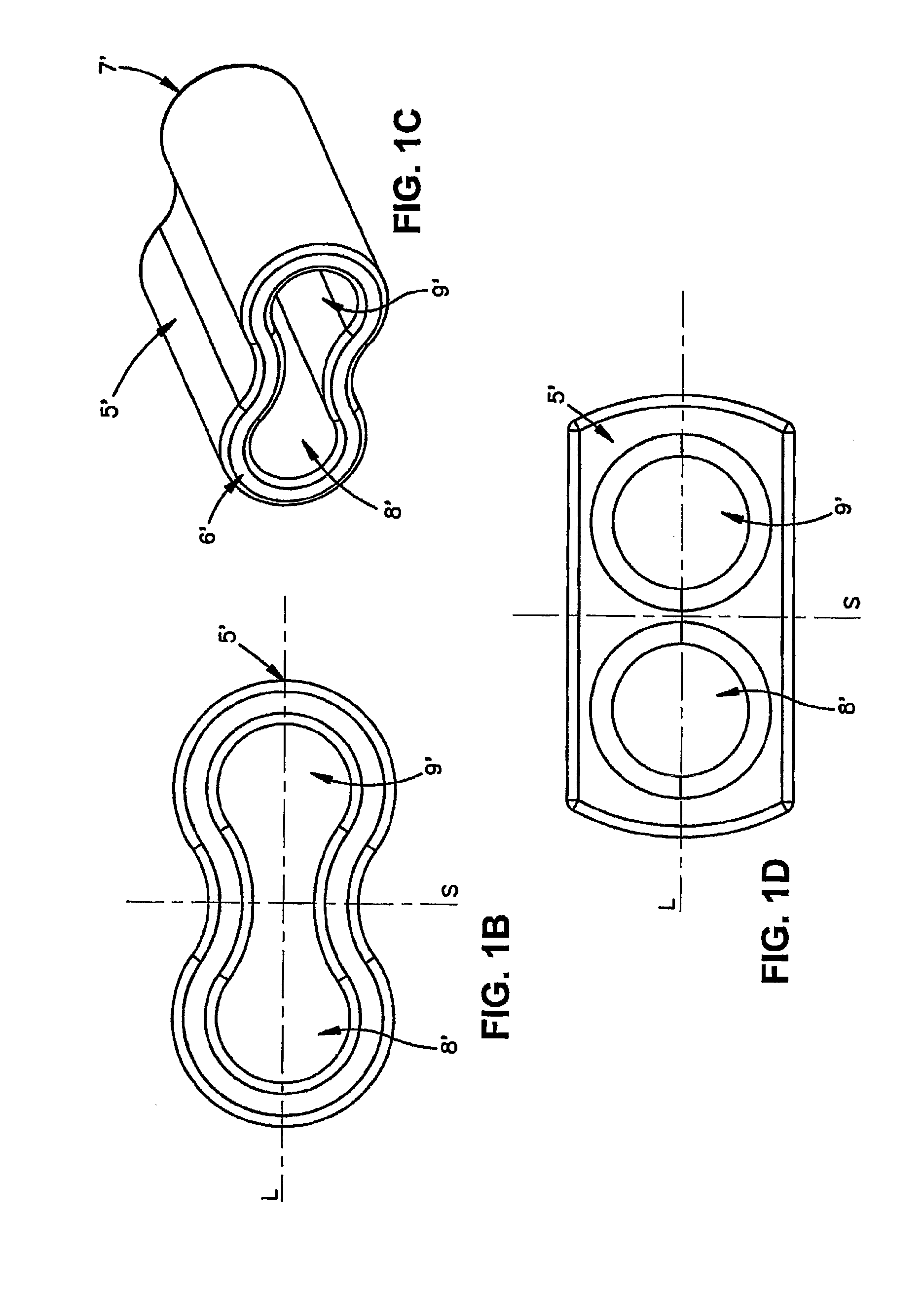 Sternal reconstruction system