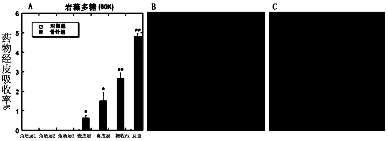 Percutaneous absorption composition and use thereof in preparation of percutaneous absorption preparation