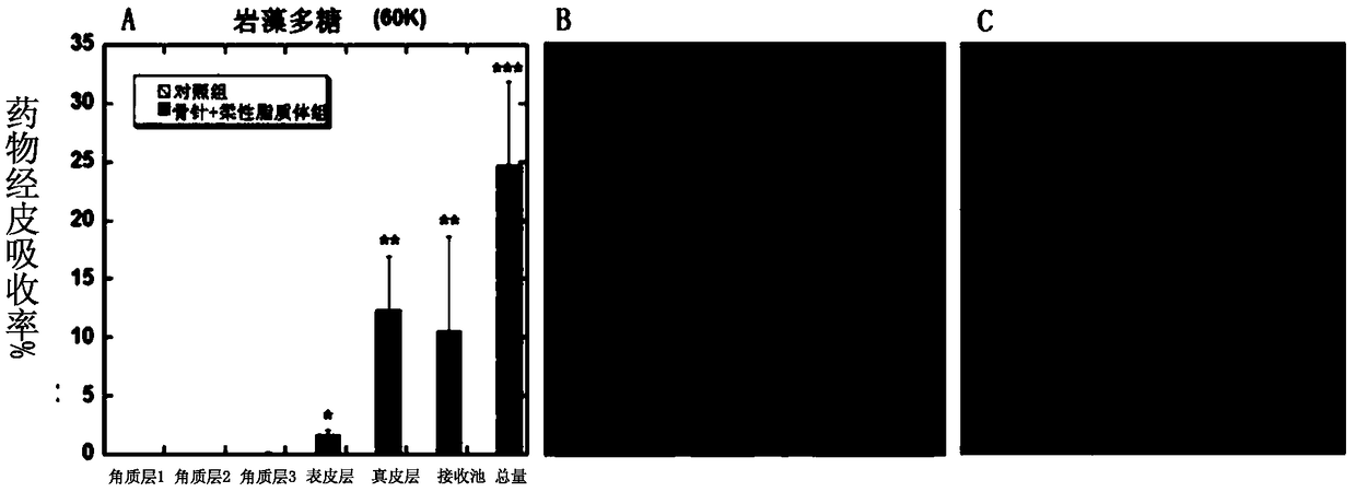 Percutaneous absorption composition and use thereof in preparation of percutaneous absorption preparation