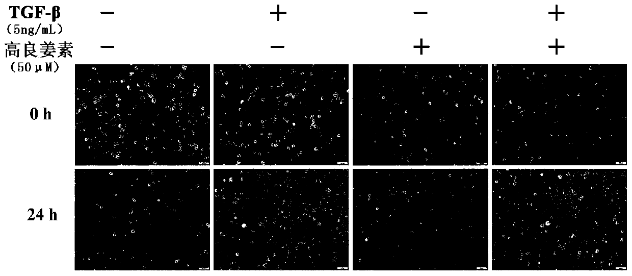 Application of galangin or salt thereof to preparation of medicines or health-care products capable of preventing and treating lung fibrosis