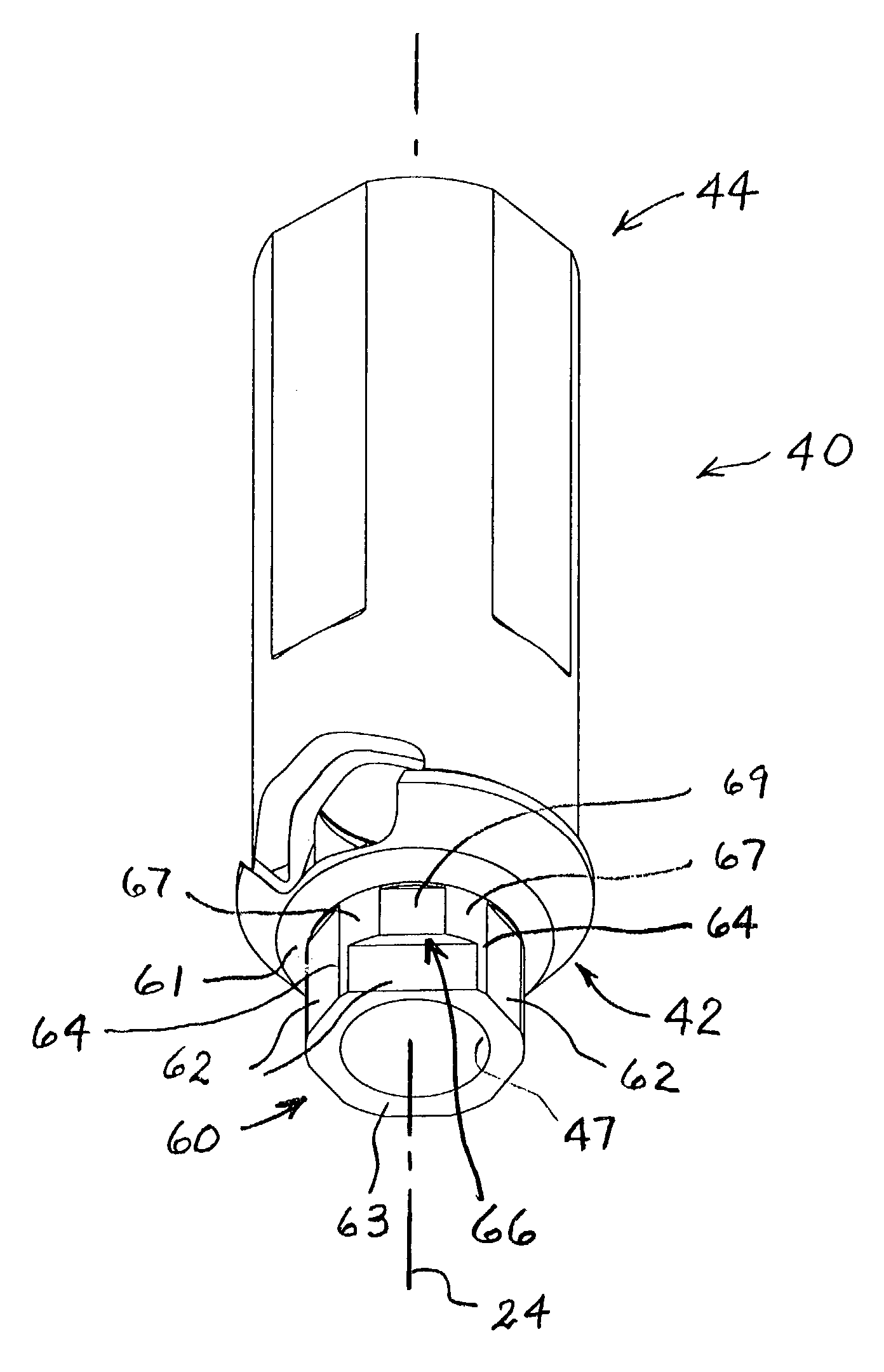 Rotationally immobilized dental implant and abutment system