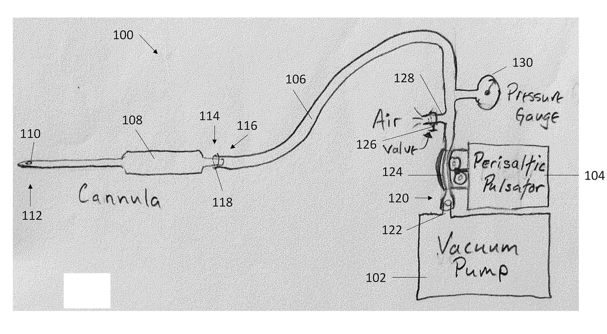 Systems, methods and handheld pulsatile aspiration and injection devices