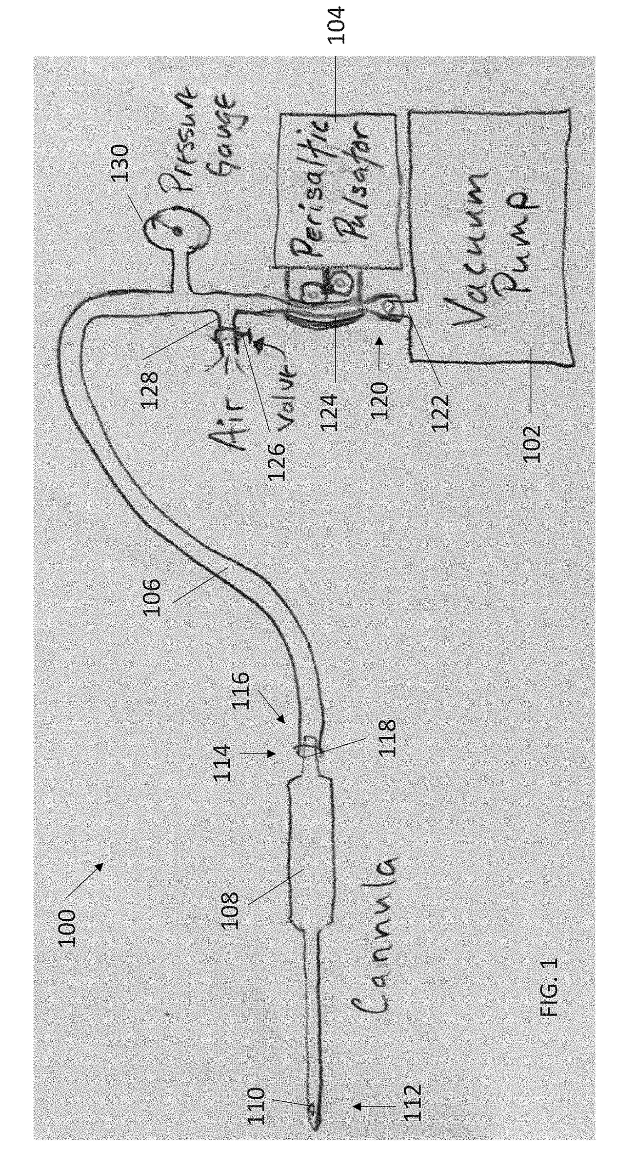 Systems, methods and handheld pulsatile aspiration and injection devices