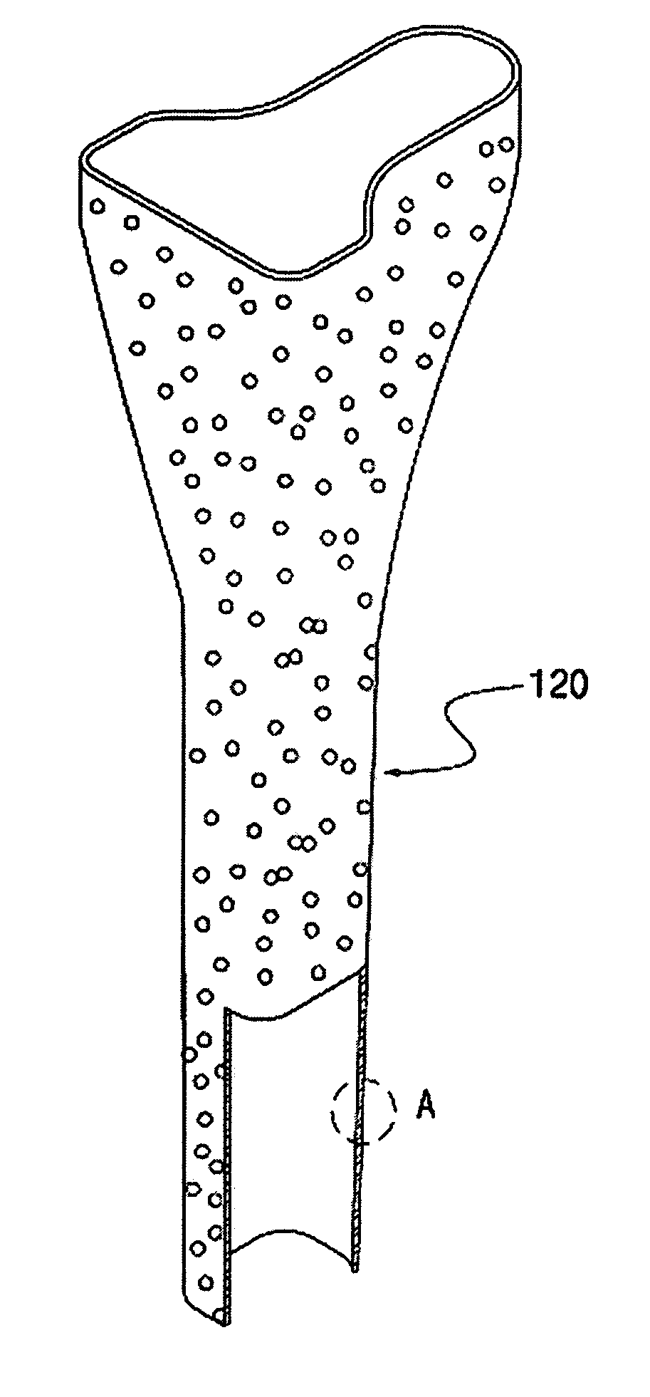 Artificial joint system