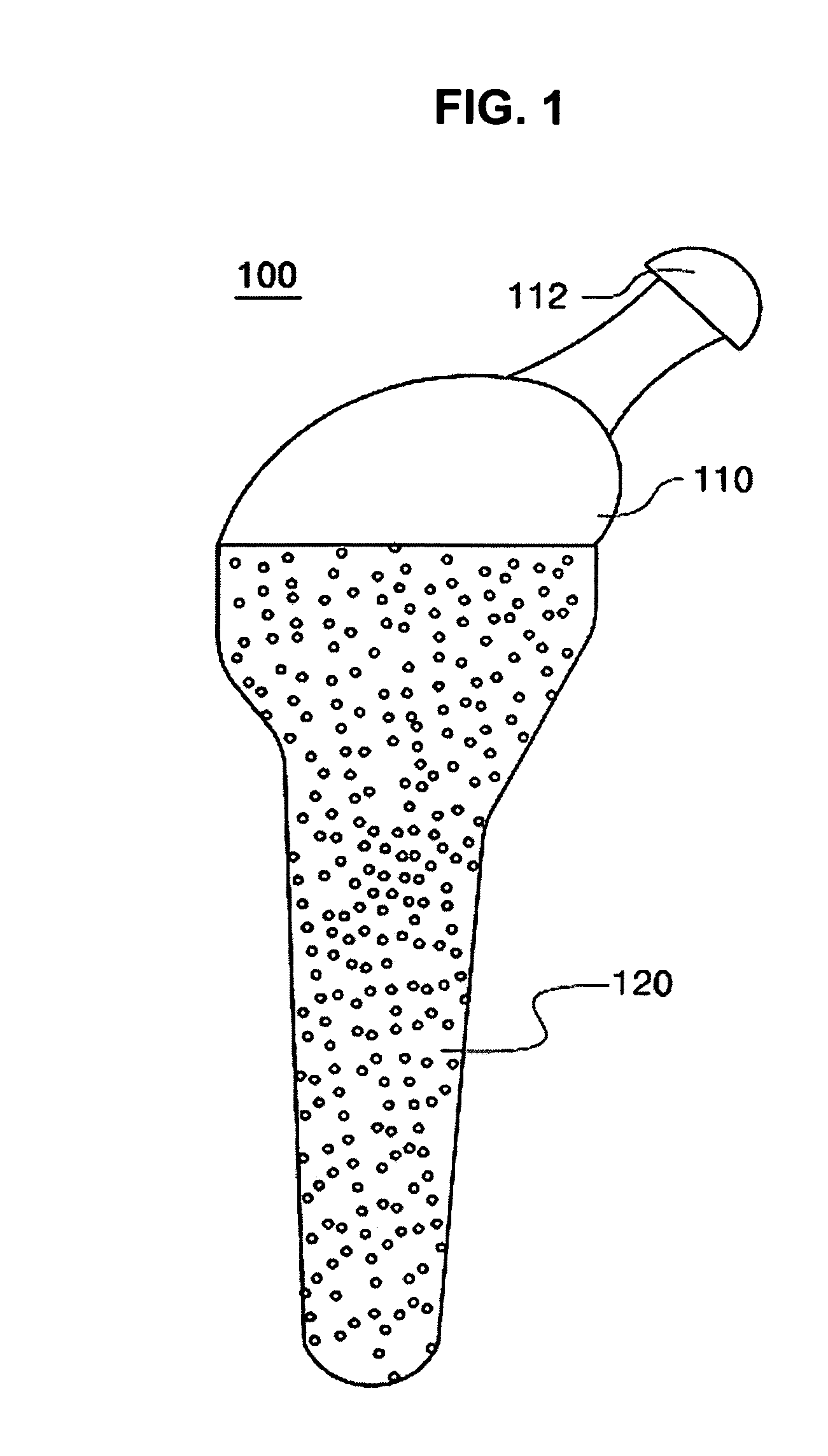 Artificial joint system