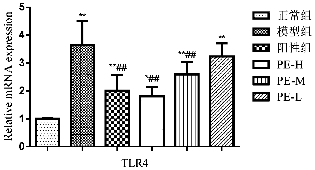 Application of pinus yunnanensis pine cone in preparing medicament for treating acute lung injury