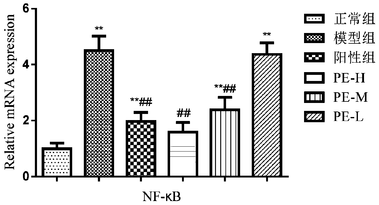 Application of pinus yunnanensis pine cone in preparing medicament for treating acute lung injury