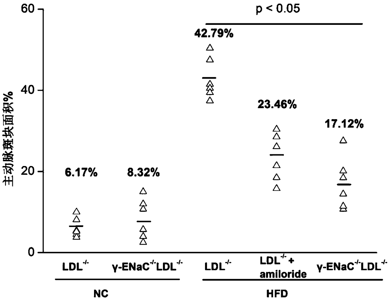 ENaC and application of inhibitor thereof in preventing, alleviating and/or treating atherosclerosis