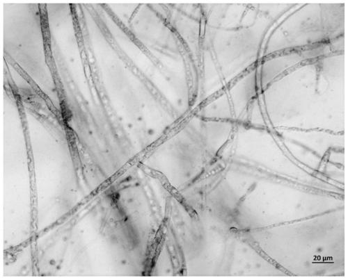 Atractylodes macrocephala endophytic fungus and application thereof in preventing and treating root rot of atractylodes macrocephala