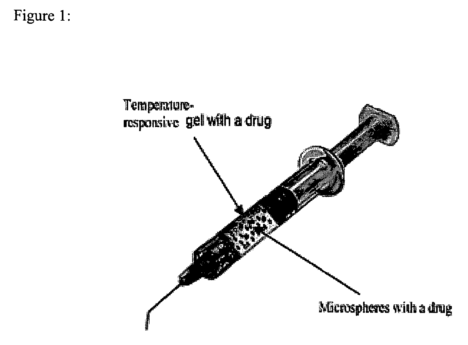 In situ controlled release drug delivery system