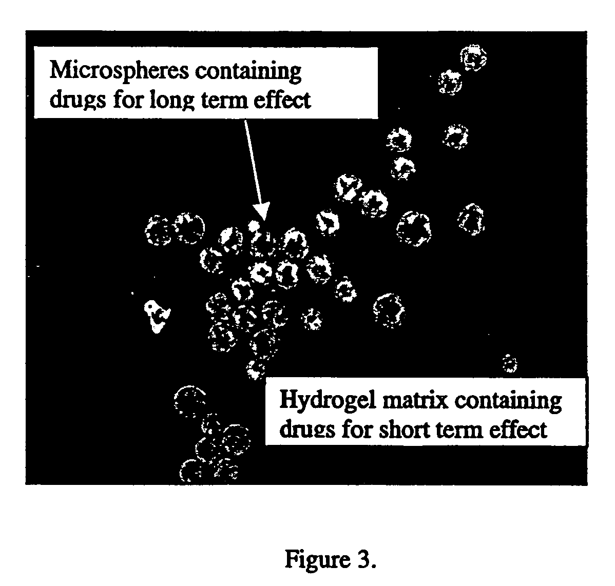 In situ controlled release drug delivery system