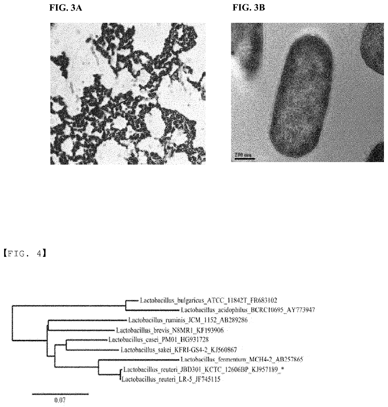 Strain having ability to inhibit obesity and pharmaceutical composition containing same