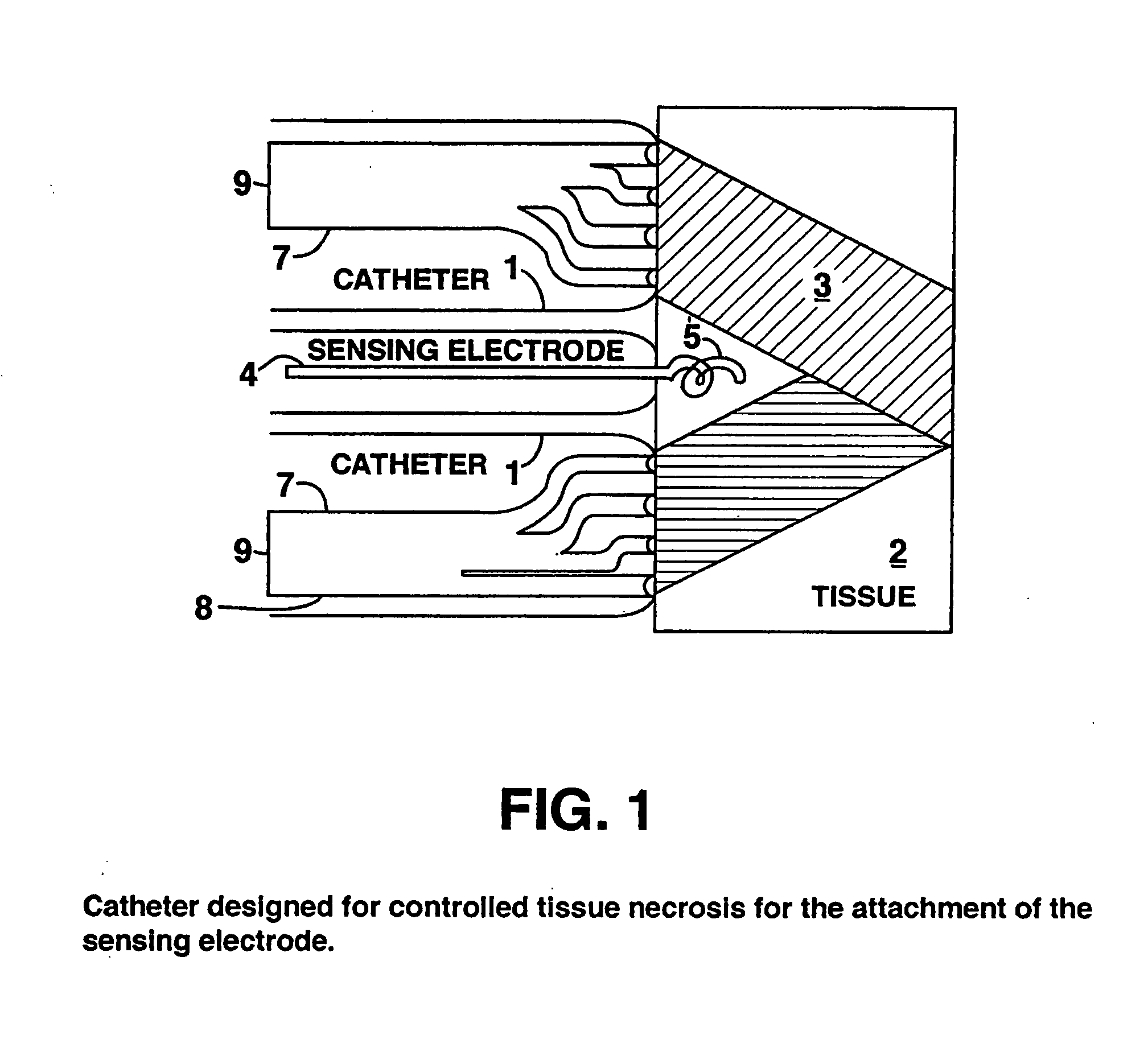 Method and device to form a sensor using isolated cardiomyocytes