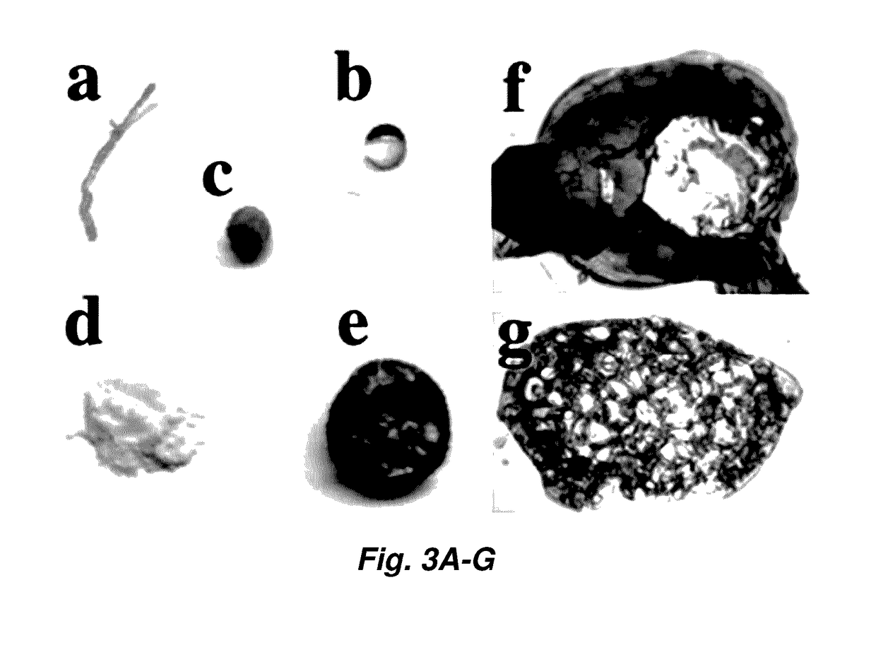 Reversible metallopolymer network