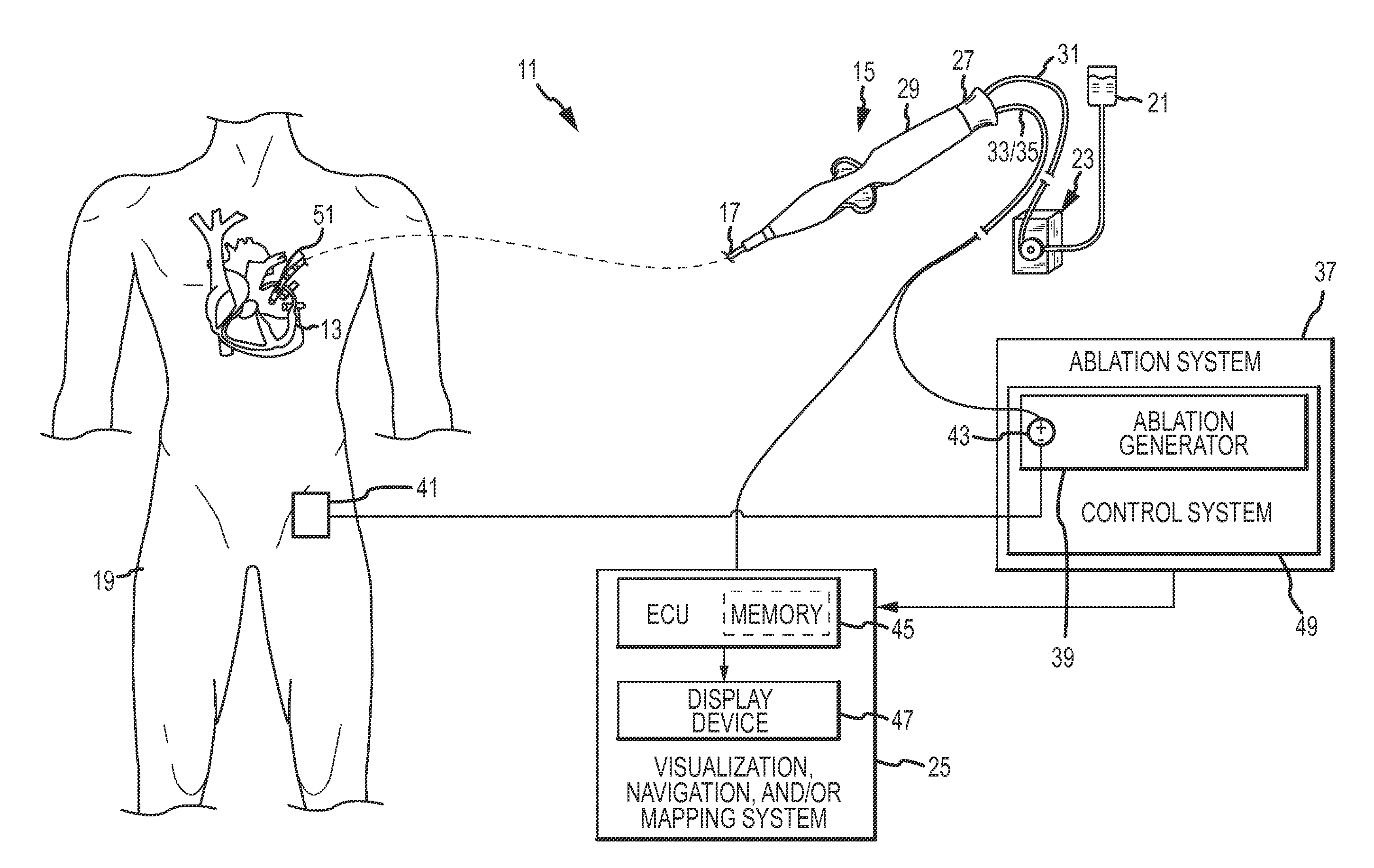 Multi-rate fluid flow and variable power deliverty for ablation electrode assemblies used in catheter ablation procedures