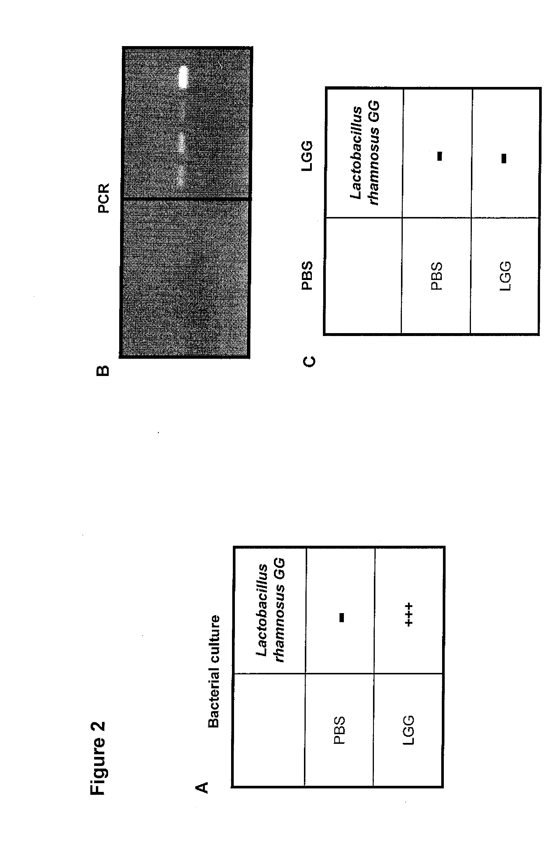 Method for preventing or treating the development of respiratory allergies