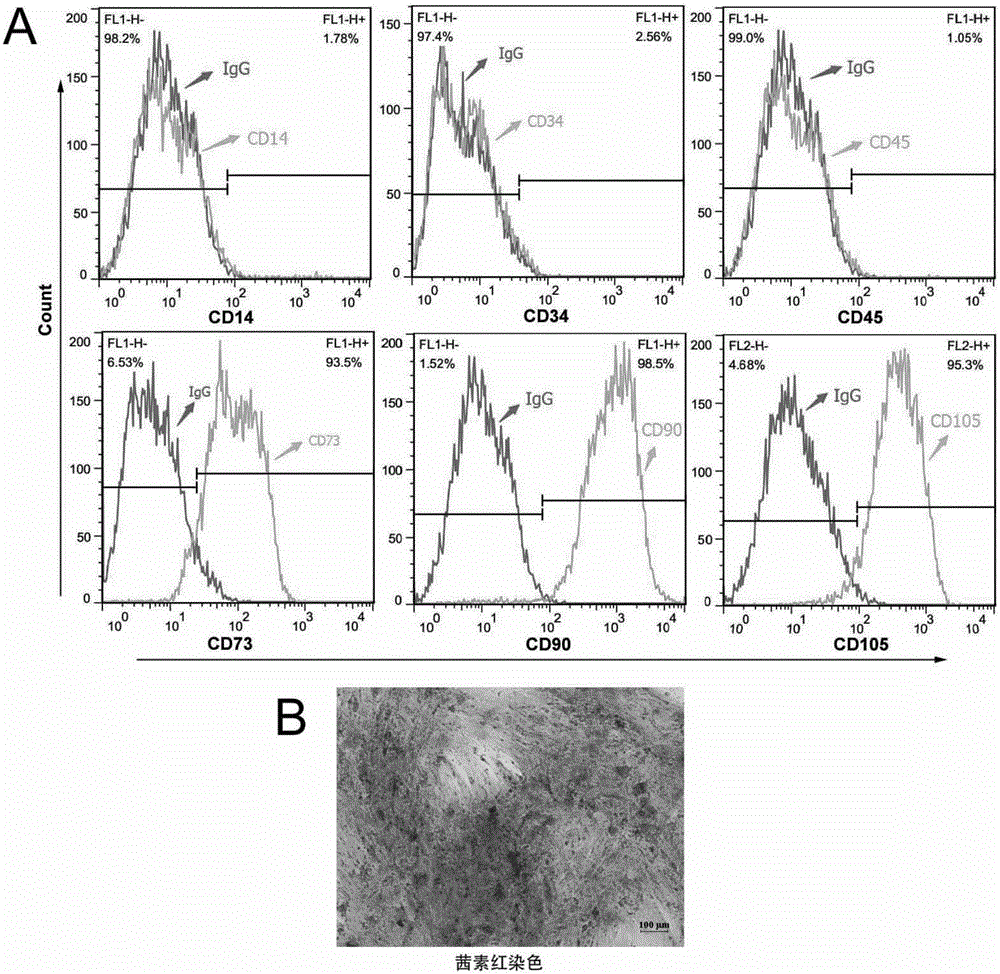 Application of mesenchymal stem cell in preparation of medicine used for treating M5 type leukaemia