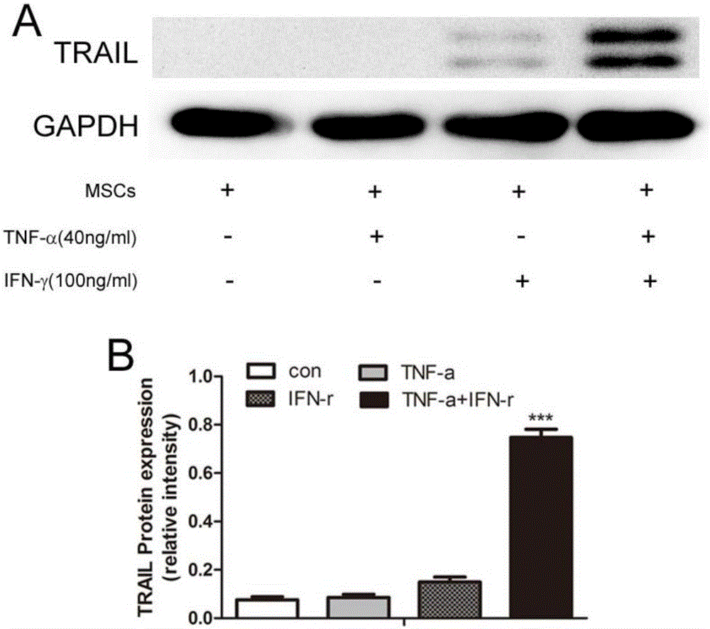 Application of mesenchymal stem cell in preparation of medicine used for treating M5 type leukaemia