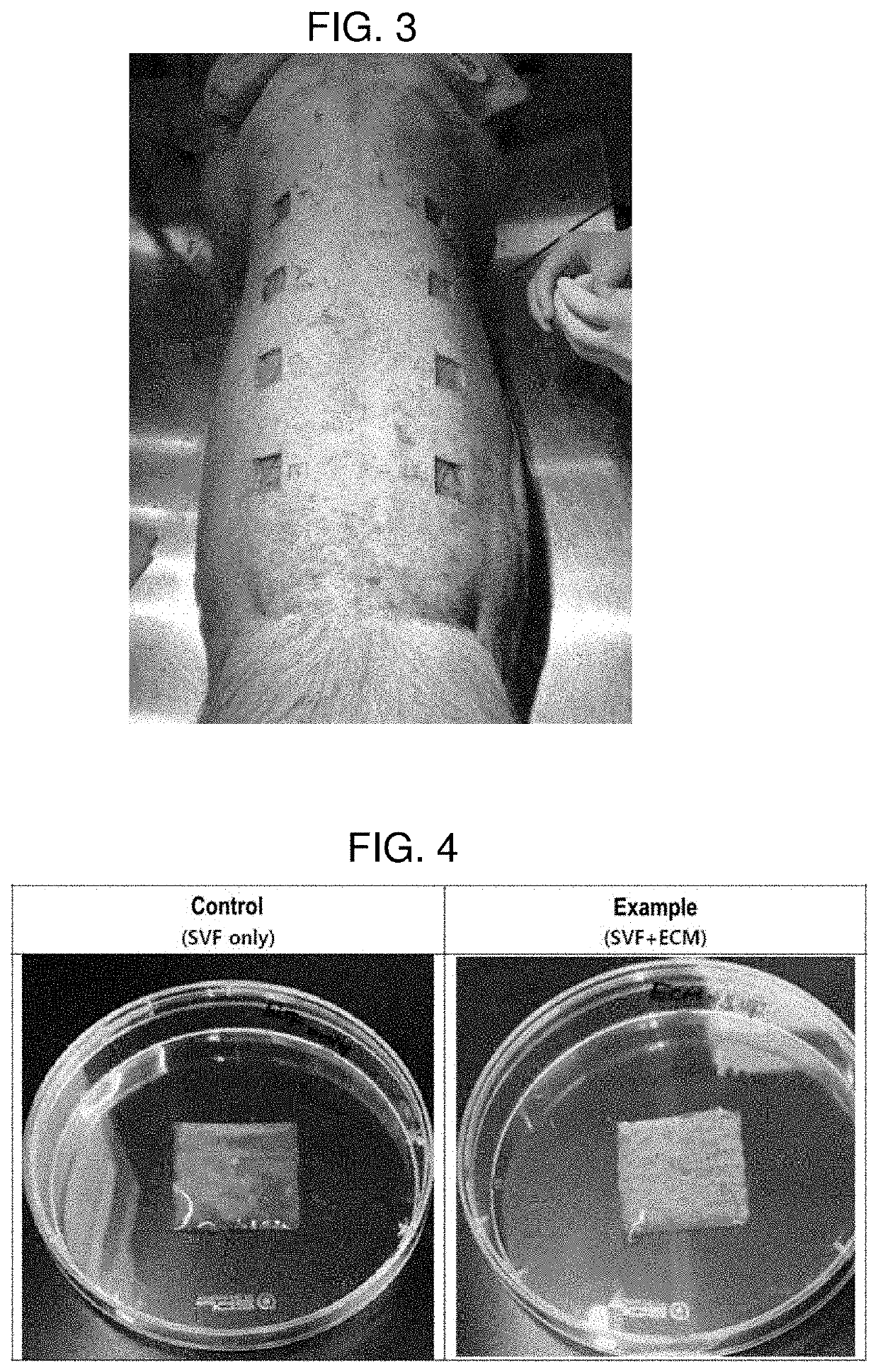 Bioink composition for dermis regeneration sheet, method for manufacturing customized dermis regeneration sheet using same, and customized dermis regeneration sheet manufactured using manufacturing method