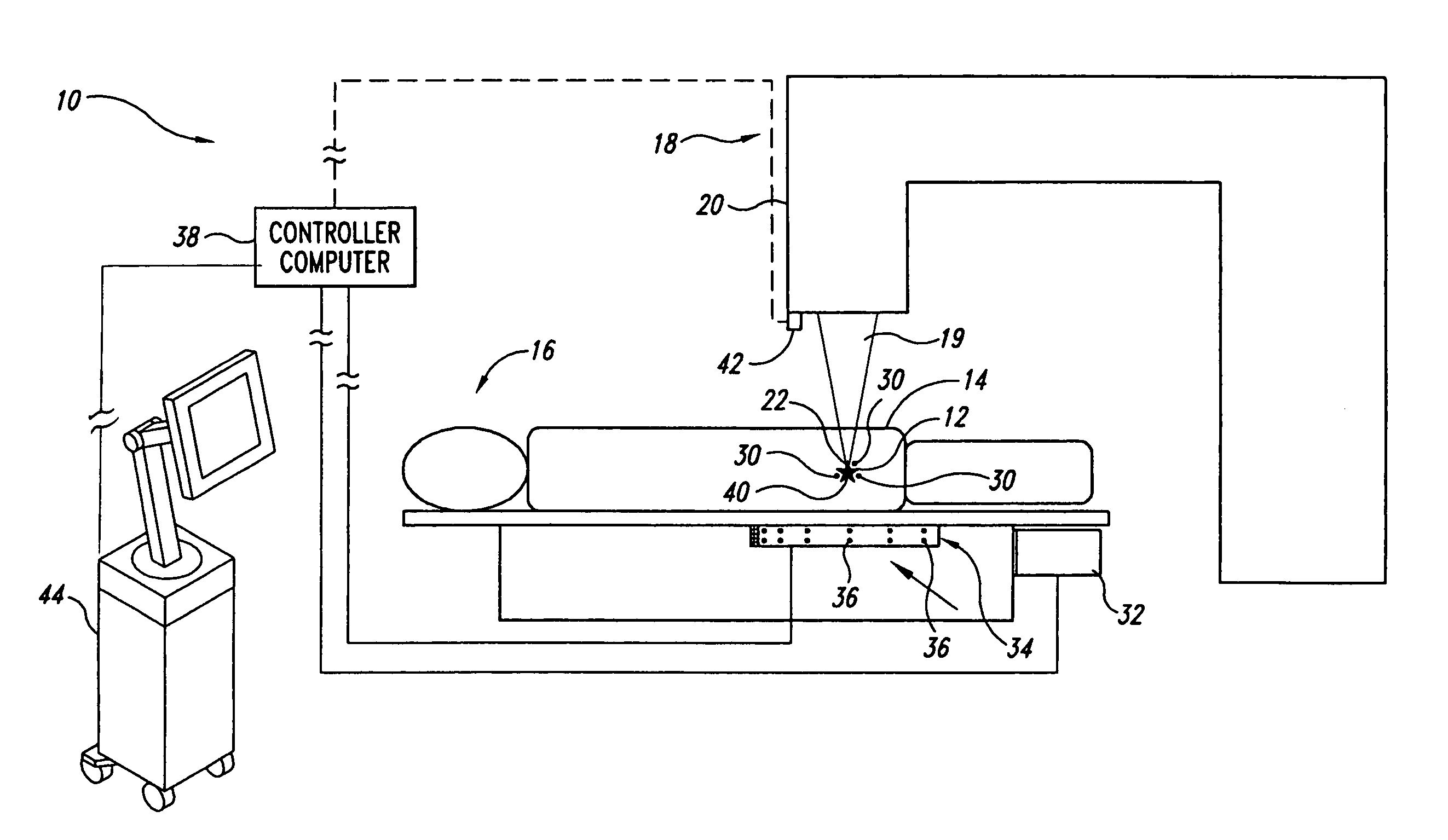 Guided radiation therapy system