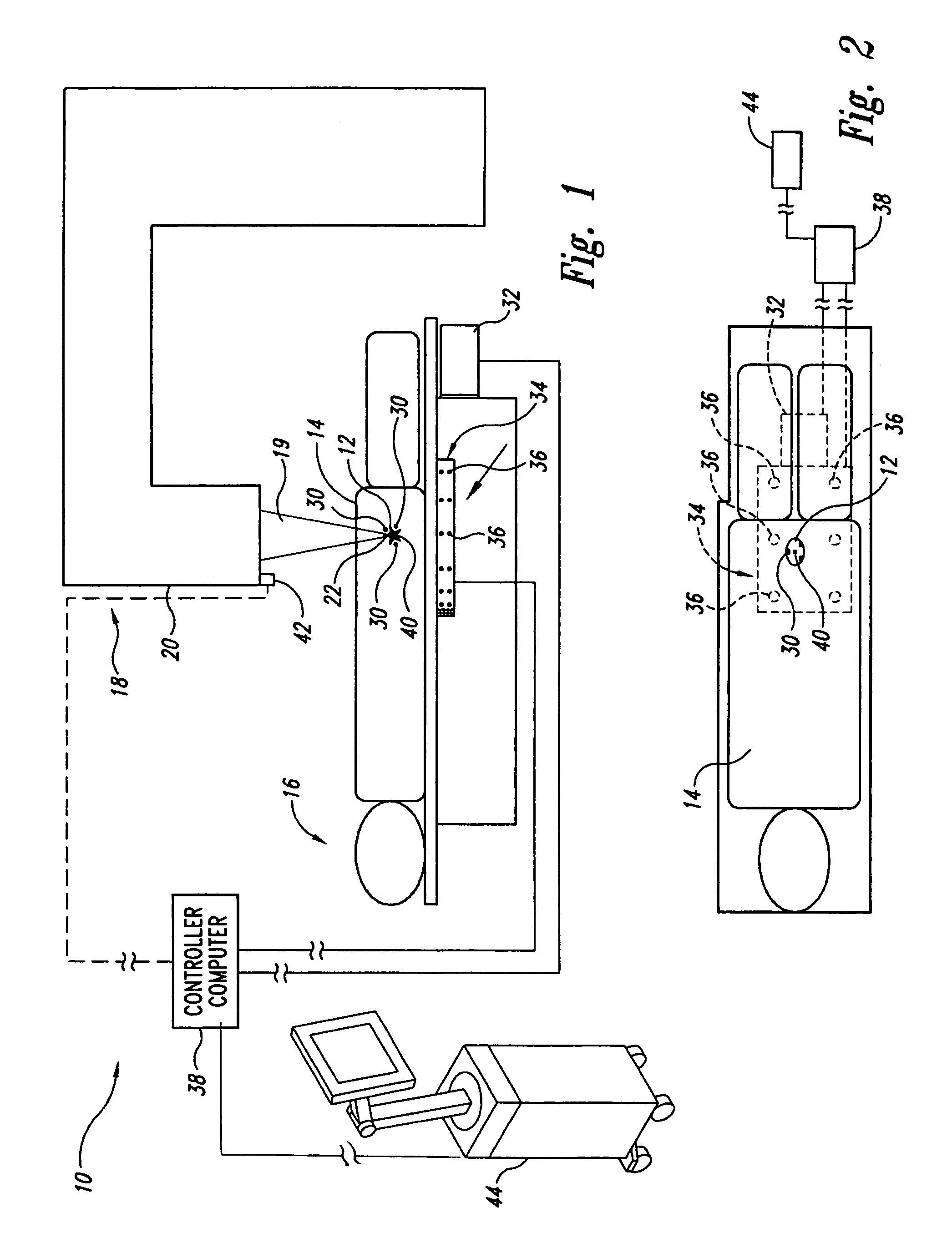 Guided radiation therapy system