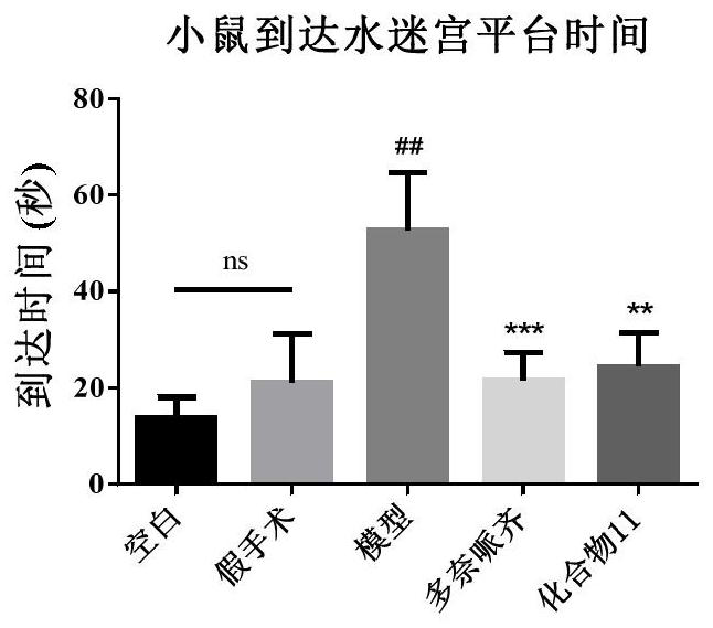 Butyrylcholine esterase selective inhibitor as well as preparation method and application thereof