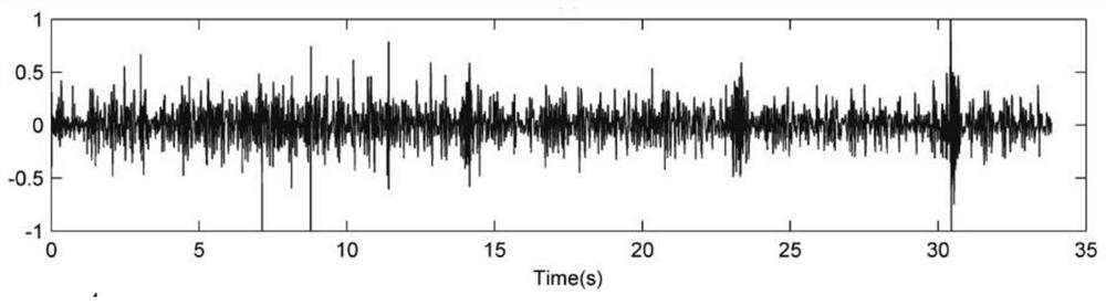 Abnormal lung auscultation sound intelligent identification system