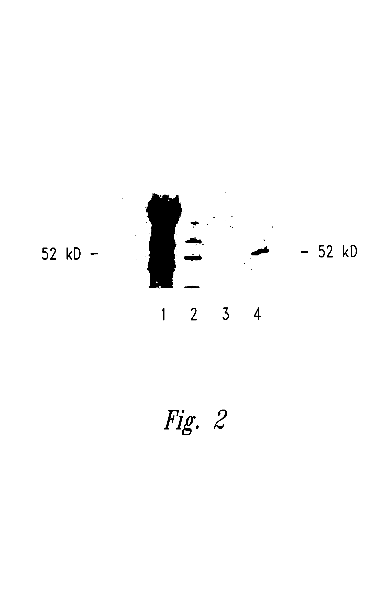 Compositions and methods for WT1 specific immunotherapy