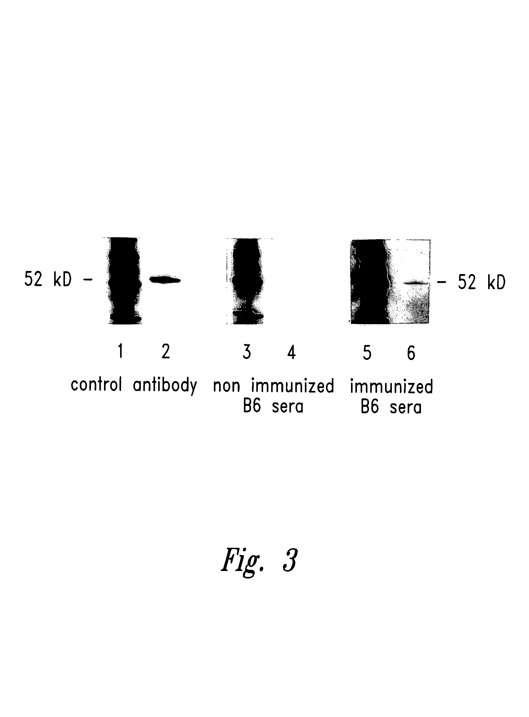 Compositions and methods for WT1 specific immunotherapy